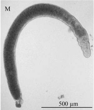 Fig Stenostomum coluber