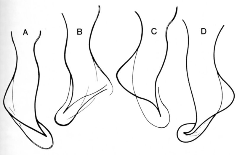 Fig Provortex pallidus