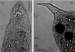 fig Stenostomum arevaloi